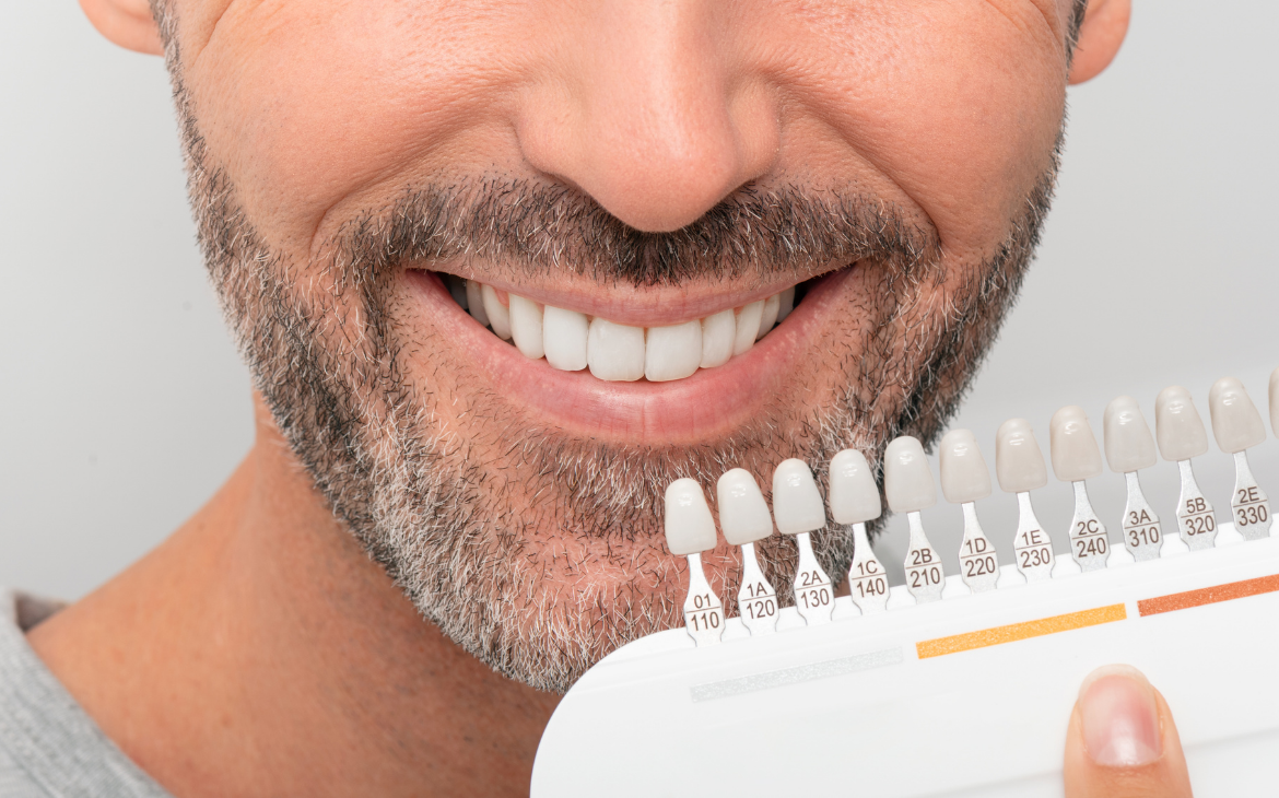 Clareamento Dental Clareamento Dental